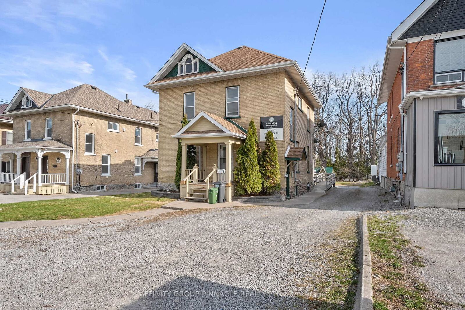 Property Photo: 255 Kent Street W ON K9V 2Z4
