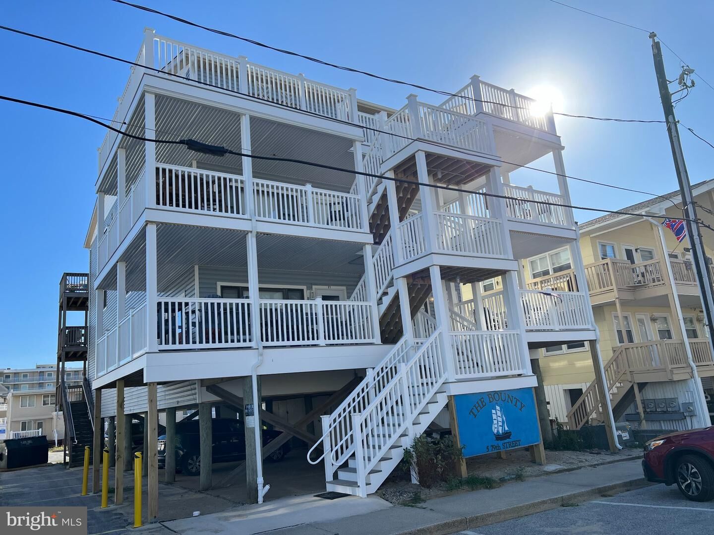 Property Photo:  5 79th Street W-2  MD 21842 